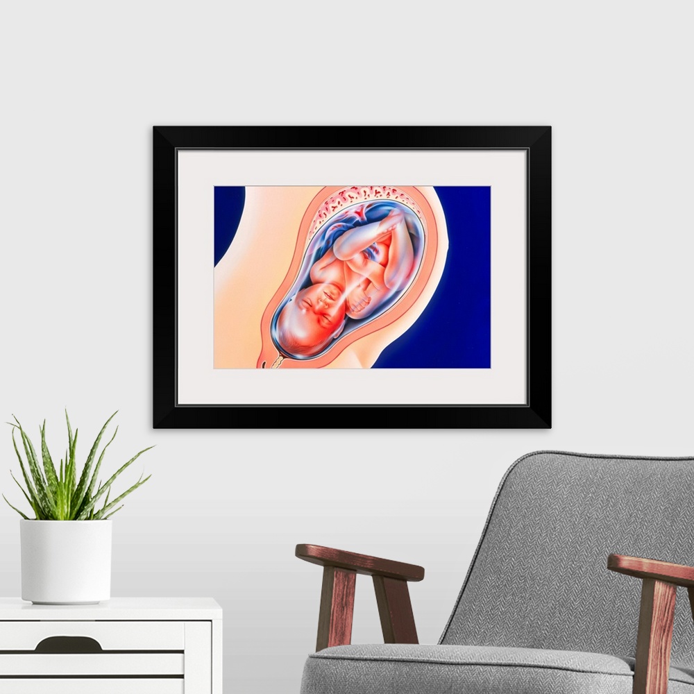 A modern room featuring Foetus. Artwork of a foetus in the womb at the 36th week of pregnancy. The foetus develops within...
