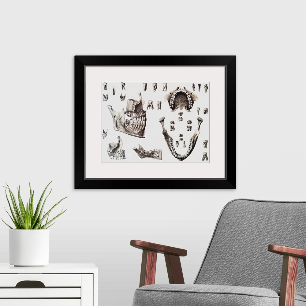 A modern room featuring Dental anatomy. Historical anatomical artwork of healthy and diseased human teeth and jaws. The t...
