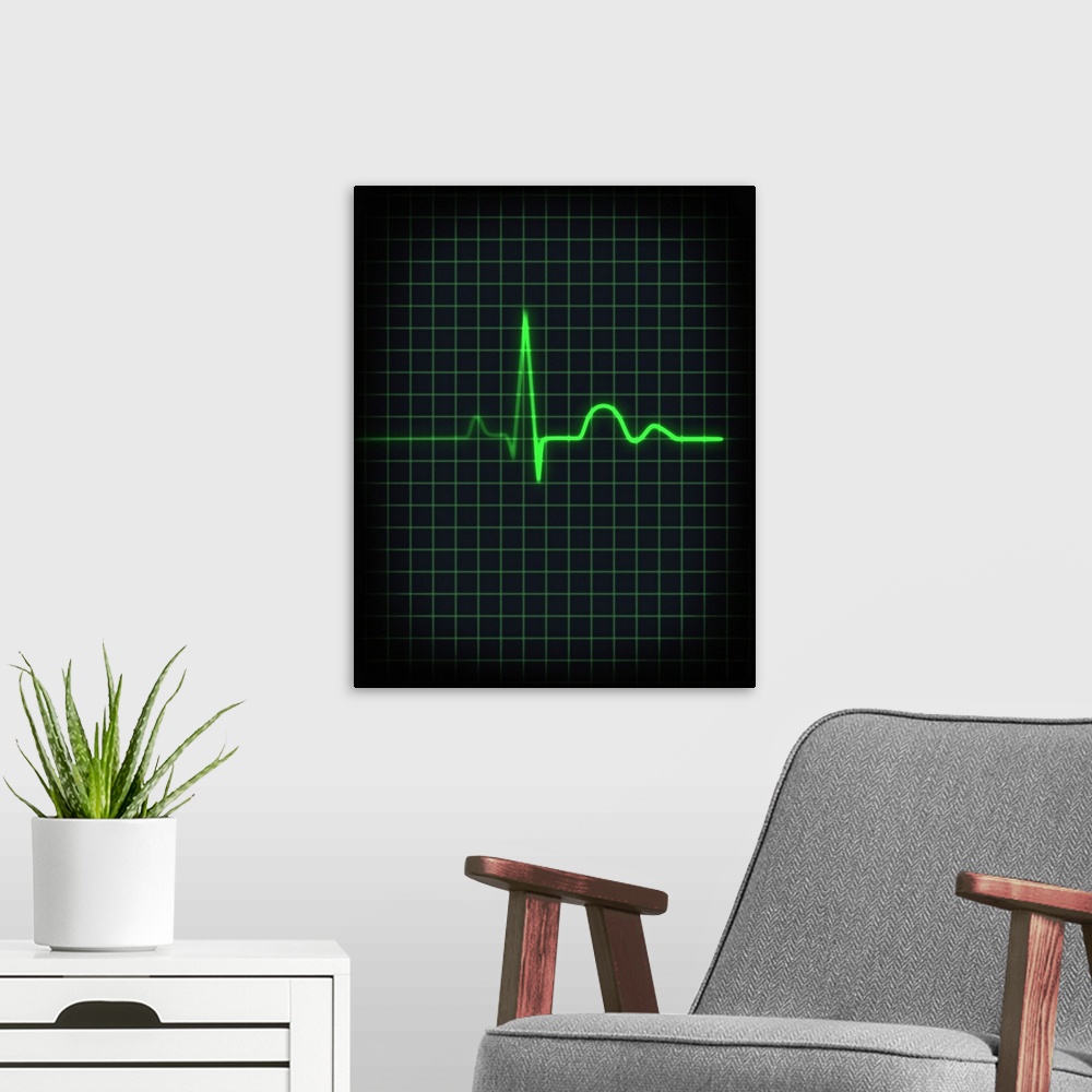 A modern room featuring Electrocardiogram of human heartbeat, close-up