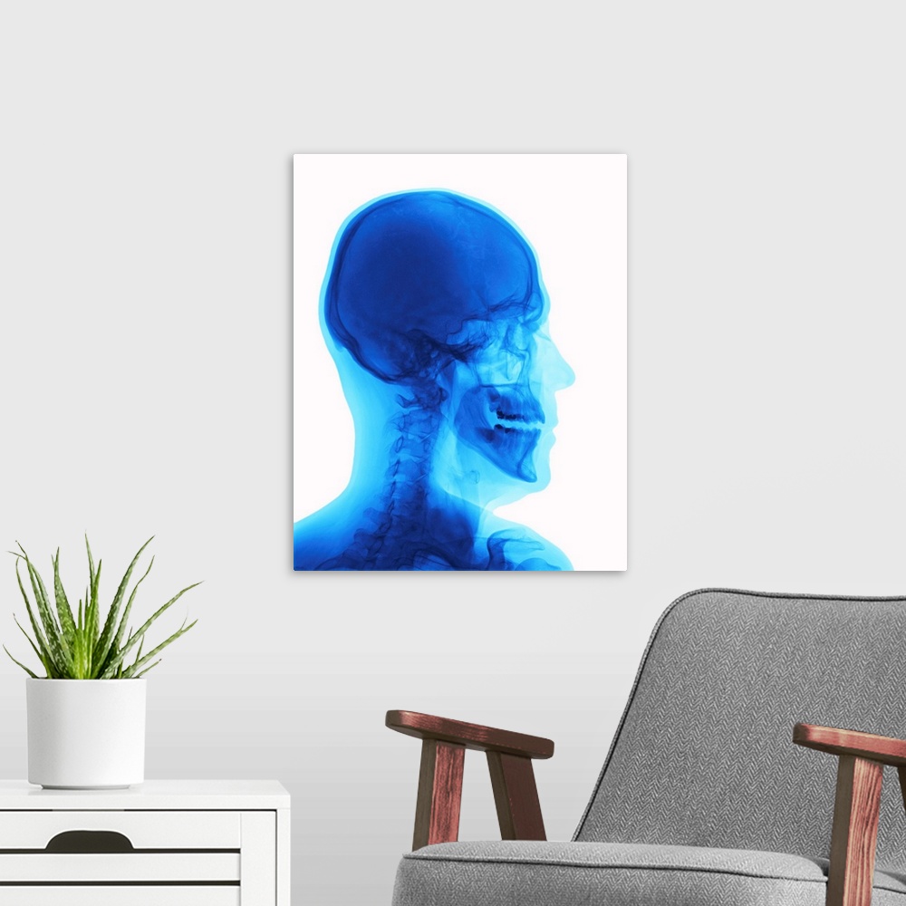 A modern room featuring Human head. X-ray of a human head in profile, showing the bones and structures of the neck, crani...