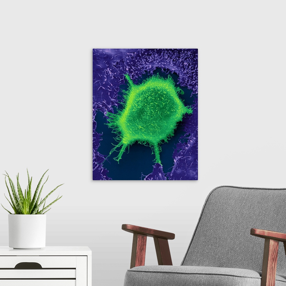 A modern room featuring Human lung epithelial cancer cell among healthy epithelial cells, coloured scanning electron micr...