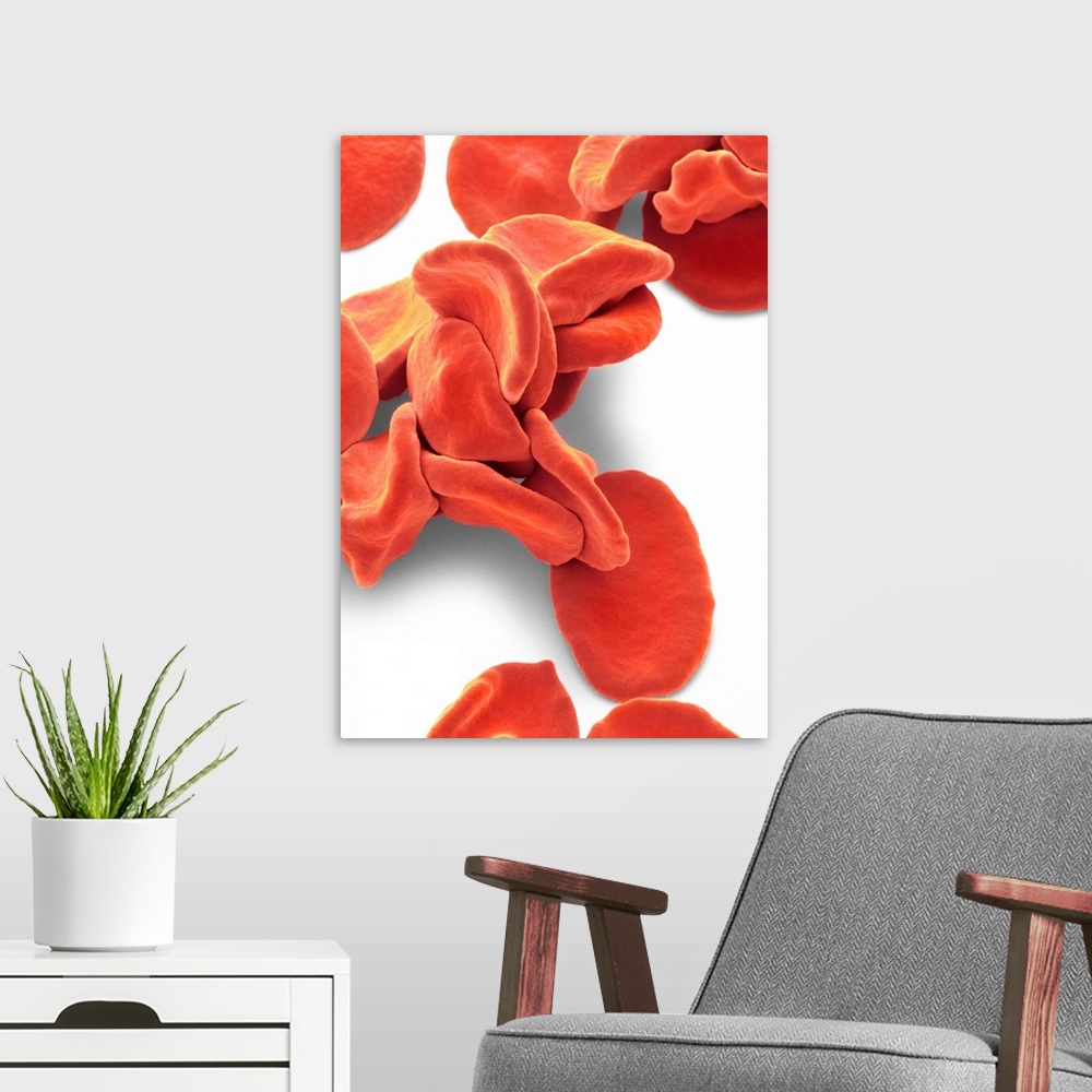 A modern room featuring Human red blood cells, coloured scanning electron micrograph (SEM) from the site of an early skin...