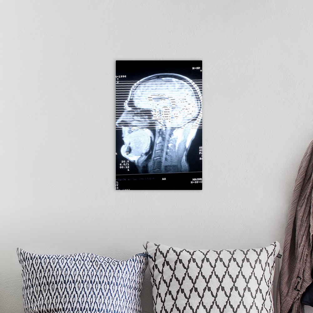 A bohemian room featuring CAT scan of human head