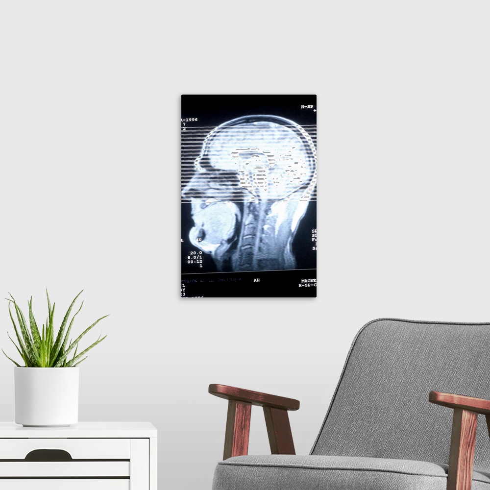 A modern room featuring CAT scan of human head