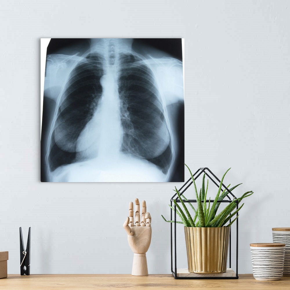 A bohemian room featuring Chest x-ray