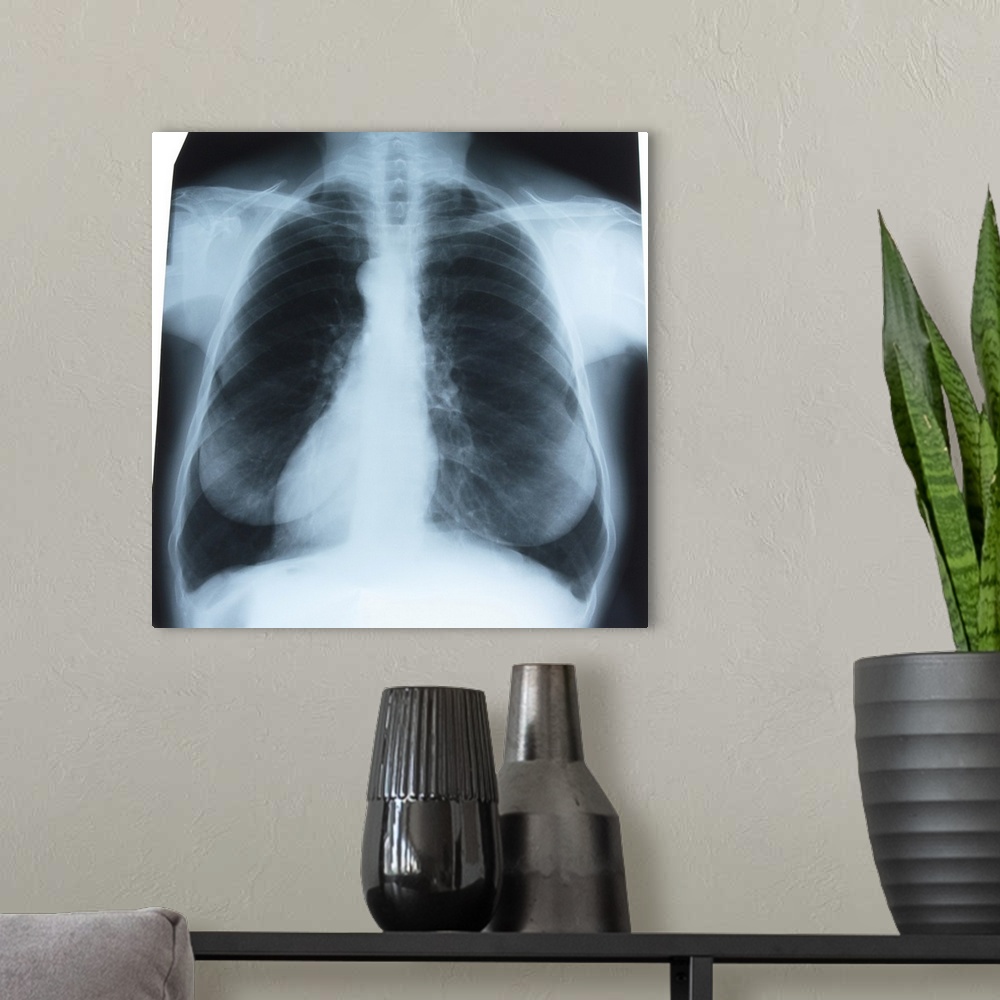 A modern room featuring Chest x-ray