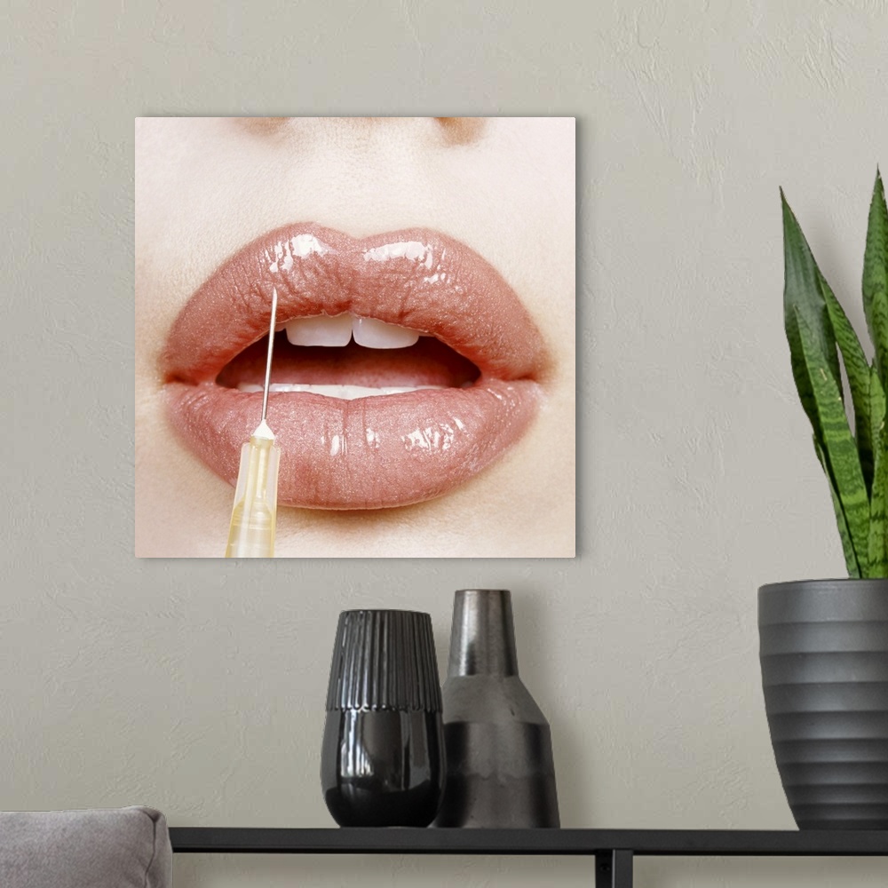 A modern room featuring Close-up of a Woman's Lips Receiving Cosmetic Surgery from a Syringe