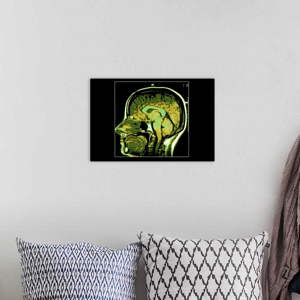 A bohemian room featuring Cross section image of human head