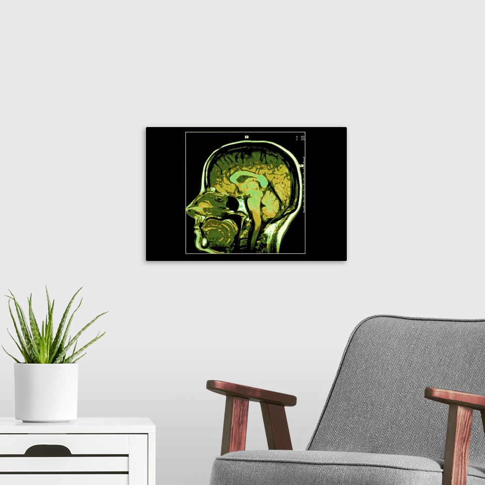 A modern room featuring Cross section image of human head