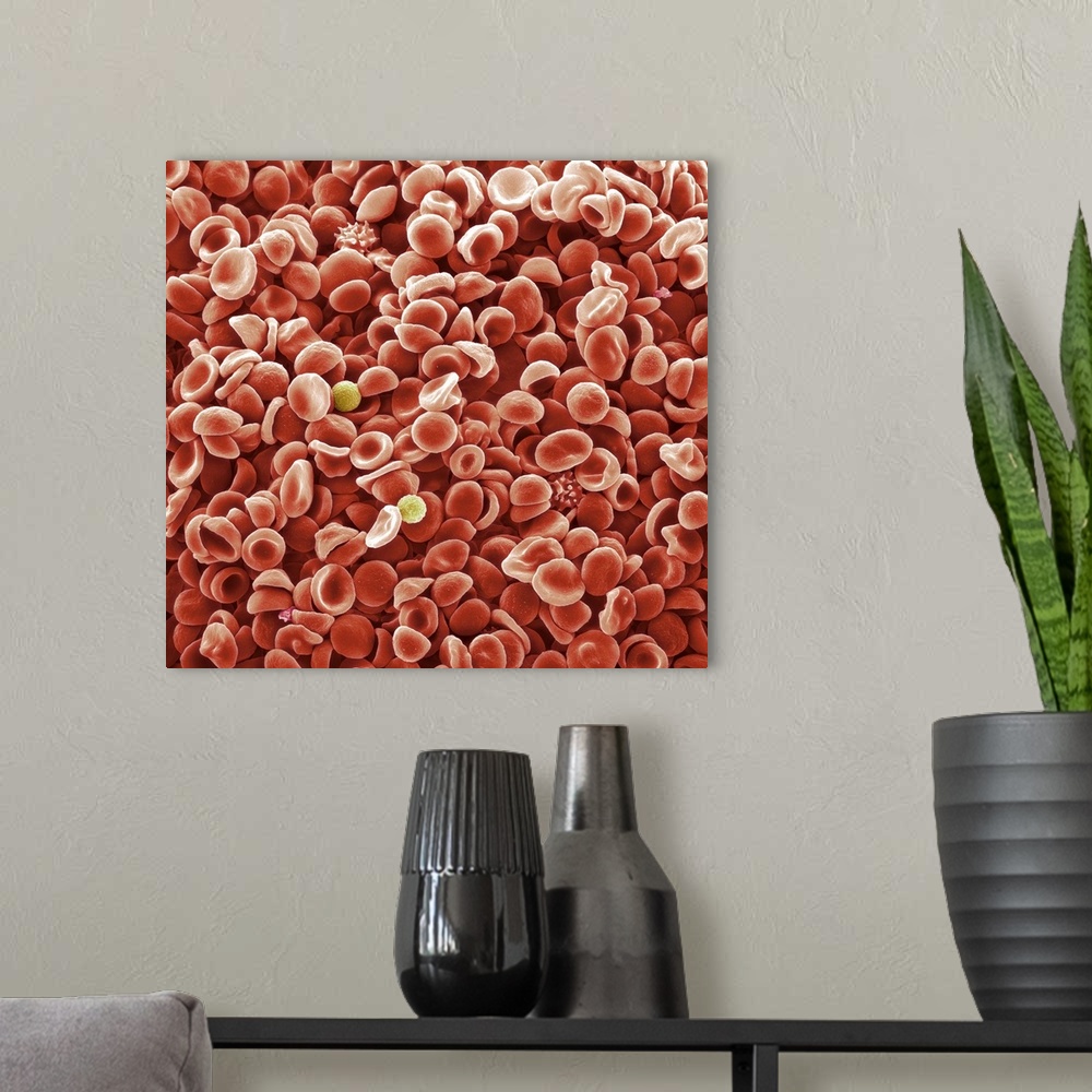 A modern room featuring Human blood cells. Coloured scanning electron micrograph (SEM) of normal human blood. The majorit...