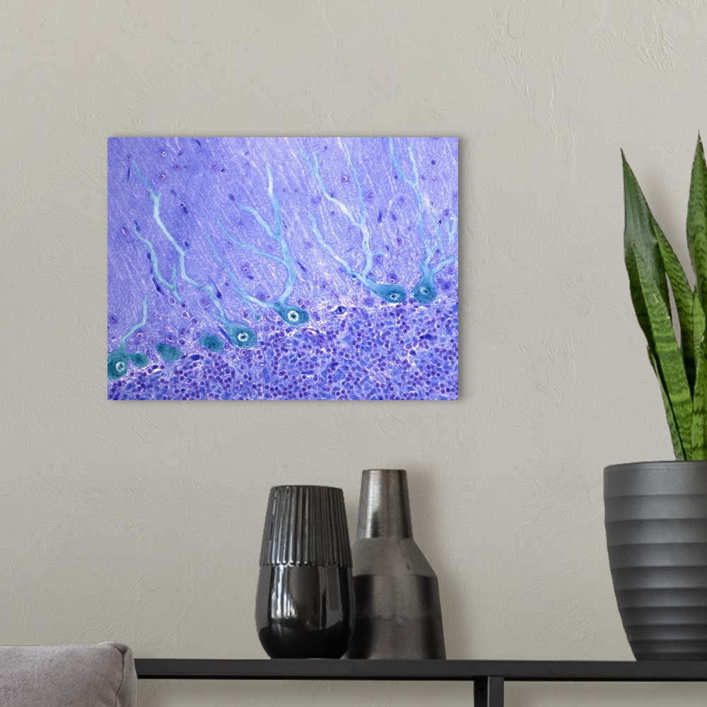 A modern room featuring Nerve cells. Light micrograph of Purkinje neurons (nerve cells, blue) in the cerebellum. These ce...