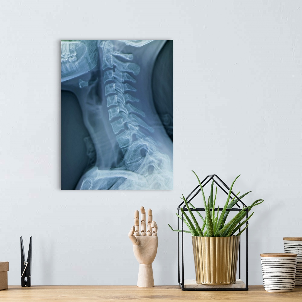 A bohemian room featuring Normal neck. Coloured X-ray of the cervical spine of a 27 year old.