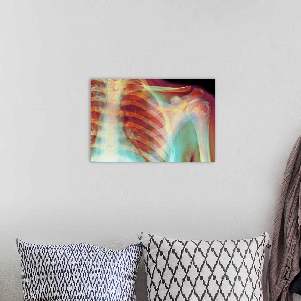 A bohemian room featuring Normal shoulder. Coloured X-ray of the shoulder of a 19 year old man.