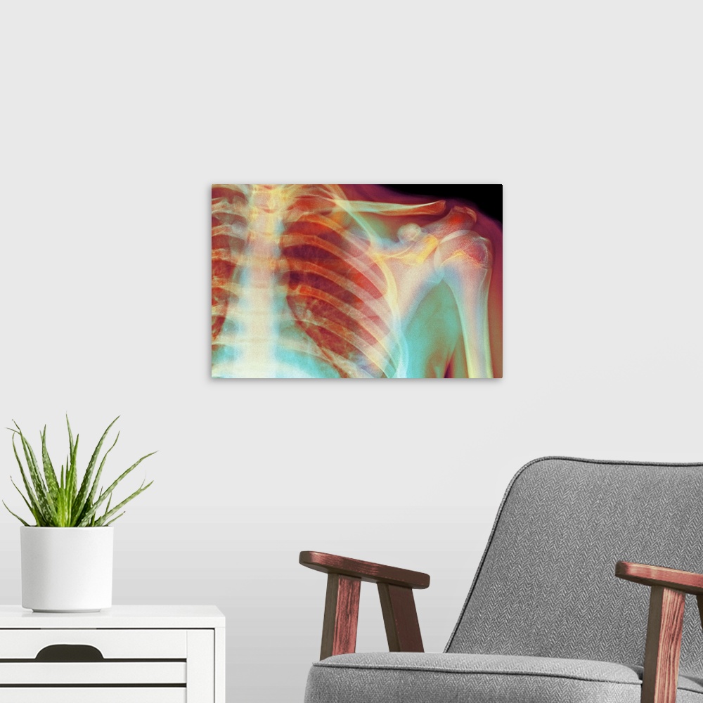 A modern room featuring Normal shoulder. Coloured X-ray of the shoulder of a 19 year old man.