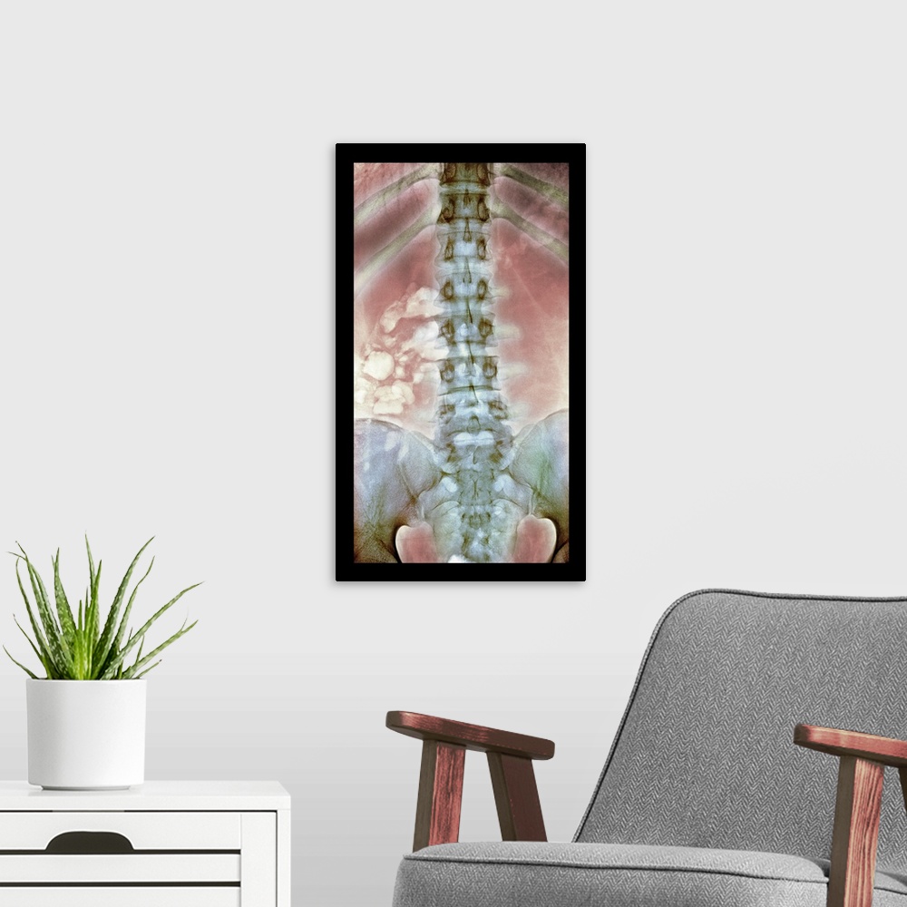 A modern room featuring Normal spine. Coloured X-ray of the spine of a 24 year old man.