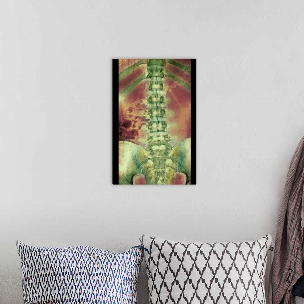 A bohemian room featuring Normal spine. Coloured X-ray of the spine of a 24 year old man.