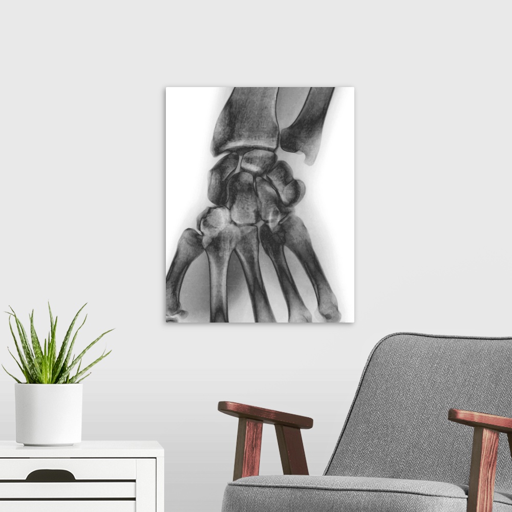 A modern room featuring Normal wrist, X-ray.