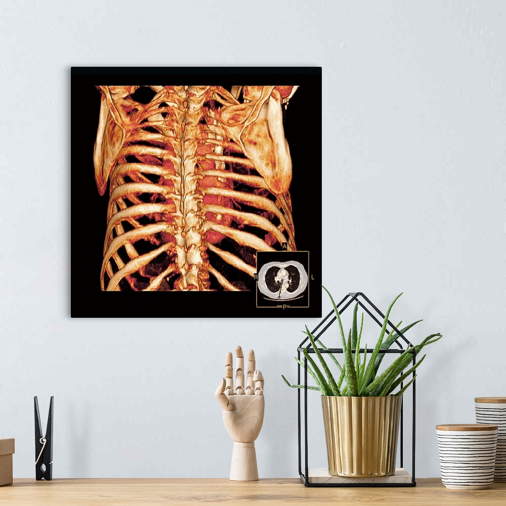 A bohemian room featuring Rib cage. Coloured three-dimensional computed tomography (CT) scan of a posterior view of a healt...