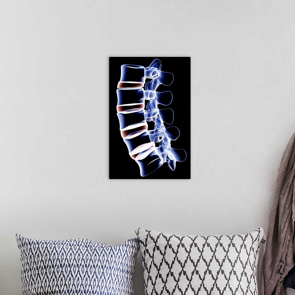 A bohemian room featuring The lumbar vertebrae