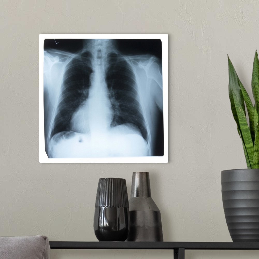 A modern room featuring X-ray of a chest cavity