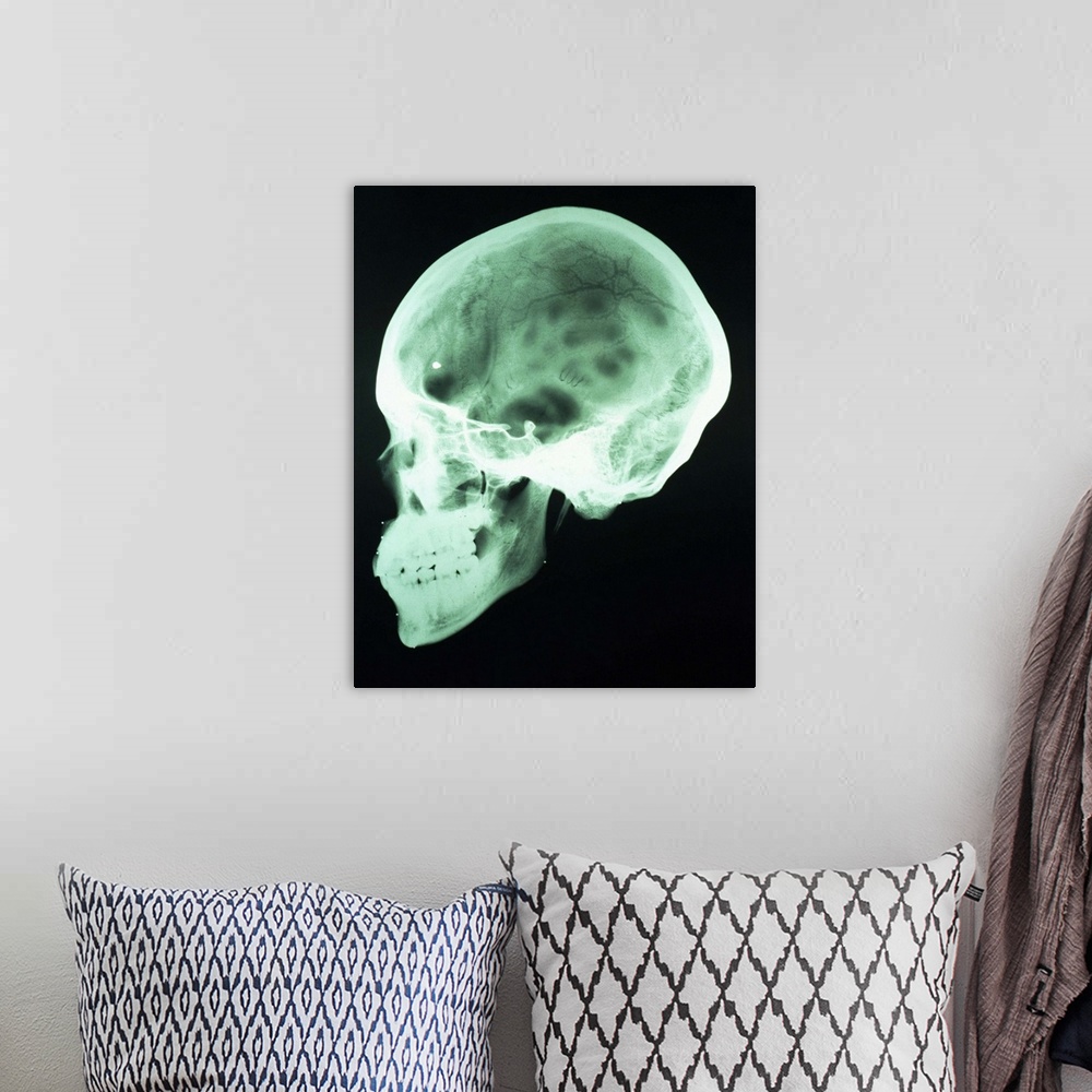 A bohemian room featuring x-ray of head