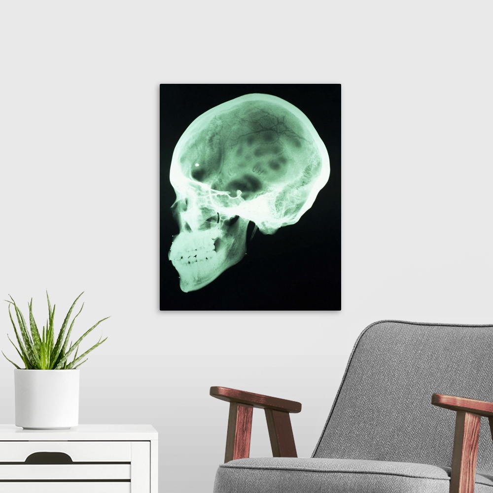 A modern room featuring x-ray of head