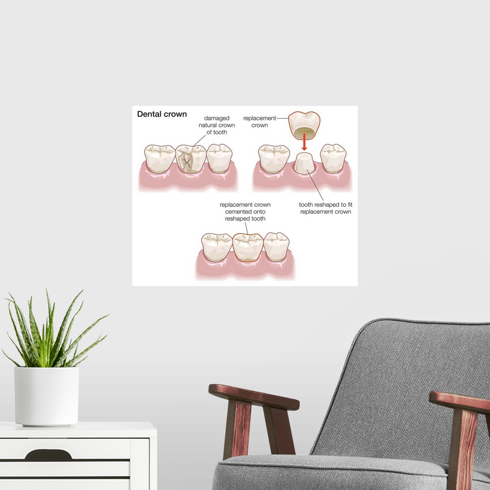A modern room featuring Dental crown