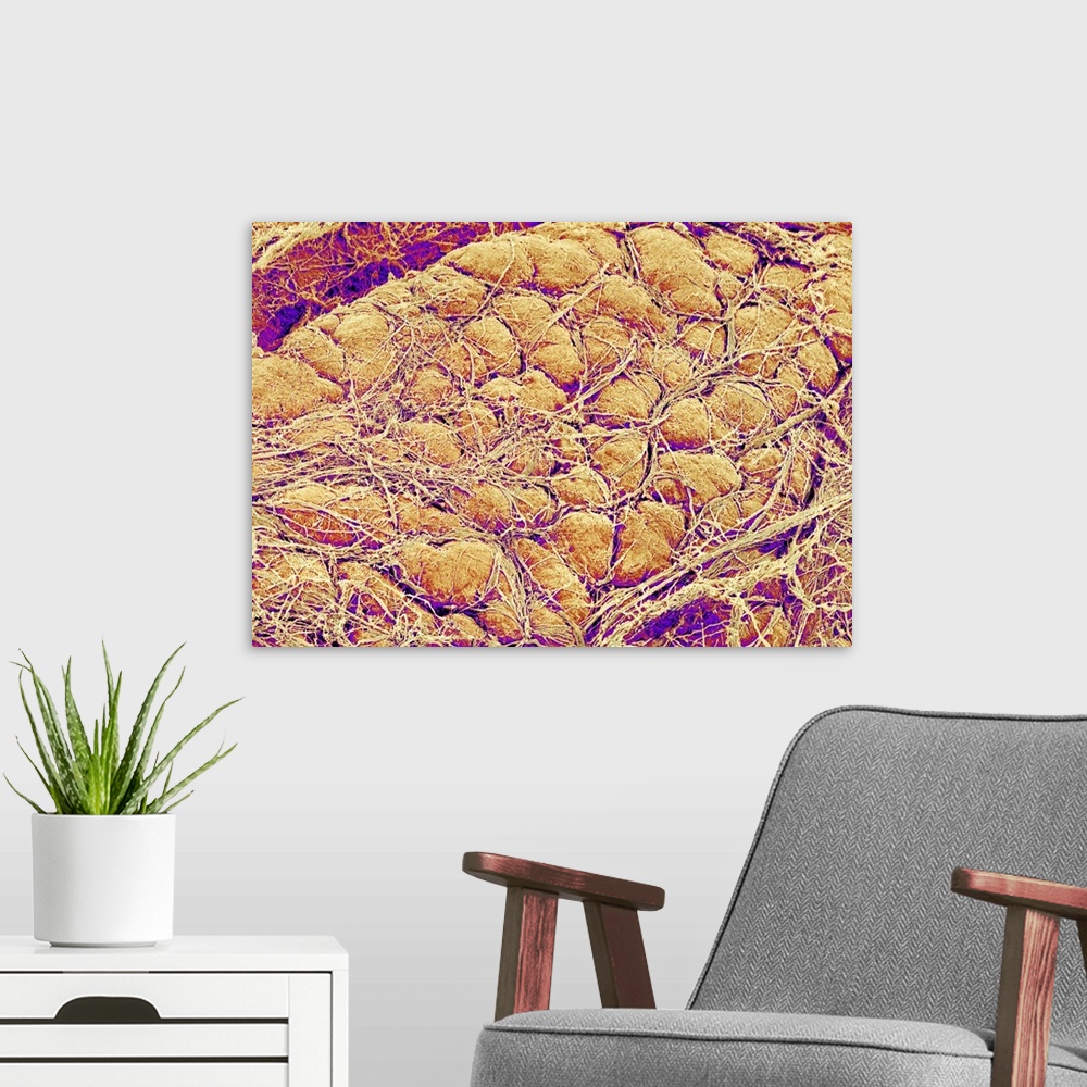 A modern room featuring Abdominal fat tissue, coloured scanning electron micrograph (SEM). Strands of connective tissue a...