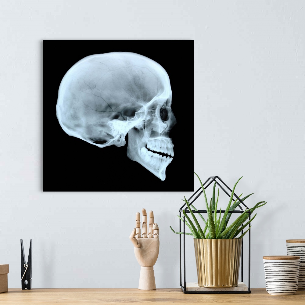 A bohemian room featuring Adult human skull. Side view X-ray showing the cranium, eye socket, nasal area and teeth. For an ...