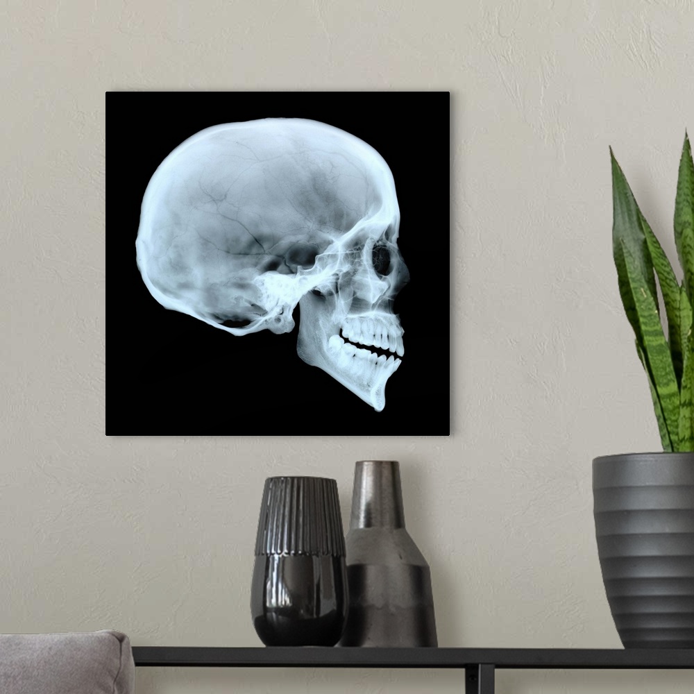 A modern room featuring Adult human skull. Side view X-ray showing the cranium, eye socket, nasal area and teeth. For an ...