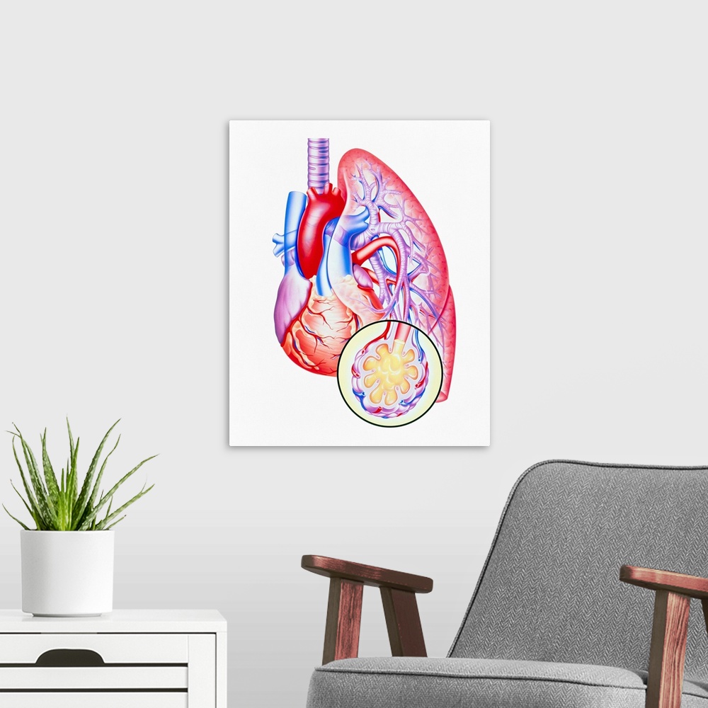 A modern room featuring Lung oedema in heart failure. Illustration showing leakage of fluid (oedema) into the lung due to...