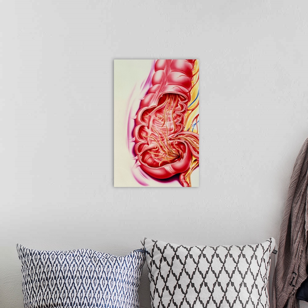 A bohemian room featuring Ascaris nematode worms. Artwork of the human intestines cutaway to reveal Ascaris lumbricoides ne...