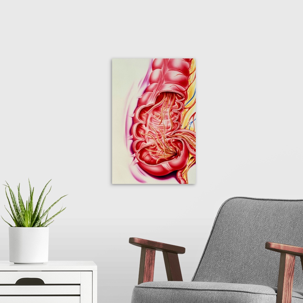 A modern room featuring Ascaris nematode worms. Artwork of the human intestines cutaway to reveal Ascaris lumbricoides ne...