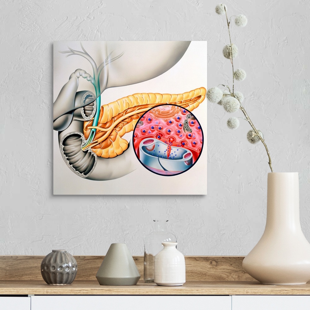 A farmhouse room featuring Insulin production. Artwork of the human pancreas showing production of the hormone insulin. The ...