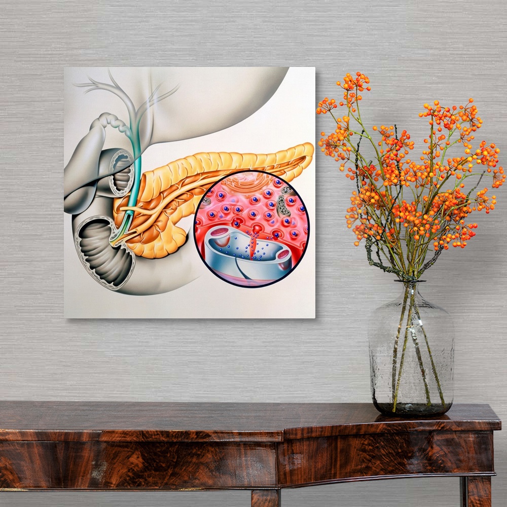 A traditional room featuring Insulin production. Artwork of the human pancreas showing production of the hormone insulin. The ...