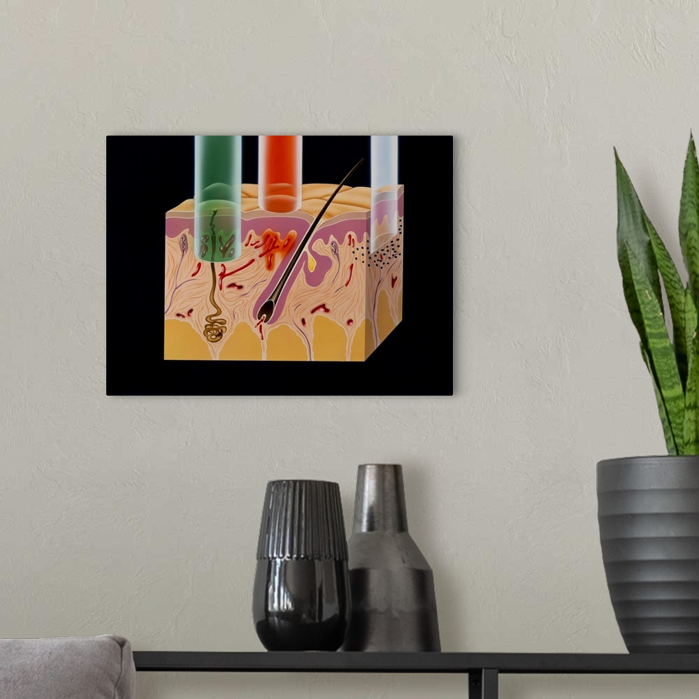 A modern room featuring Artwork of a section of human skin showing the relative degree of penetration of three types of l...