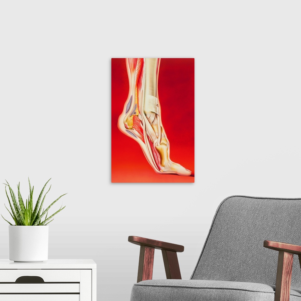 A modern room featuring Calcaneal spur and foot pain. Illustration showing causes of pain in the foot. At top left are th...