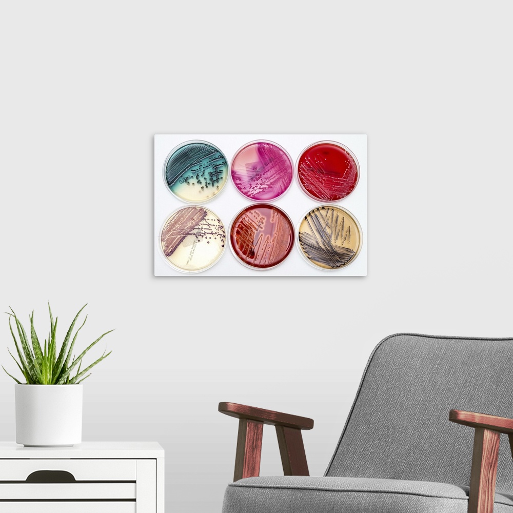A modern room featuring Bacterial growth on culture media. Colourful selection of the variety of differential and selecti...