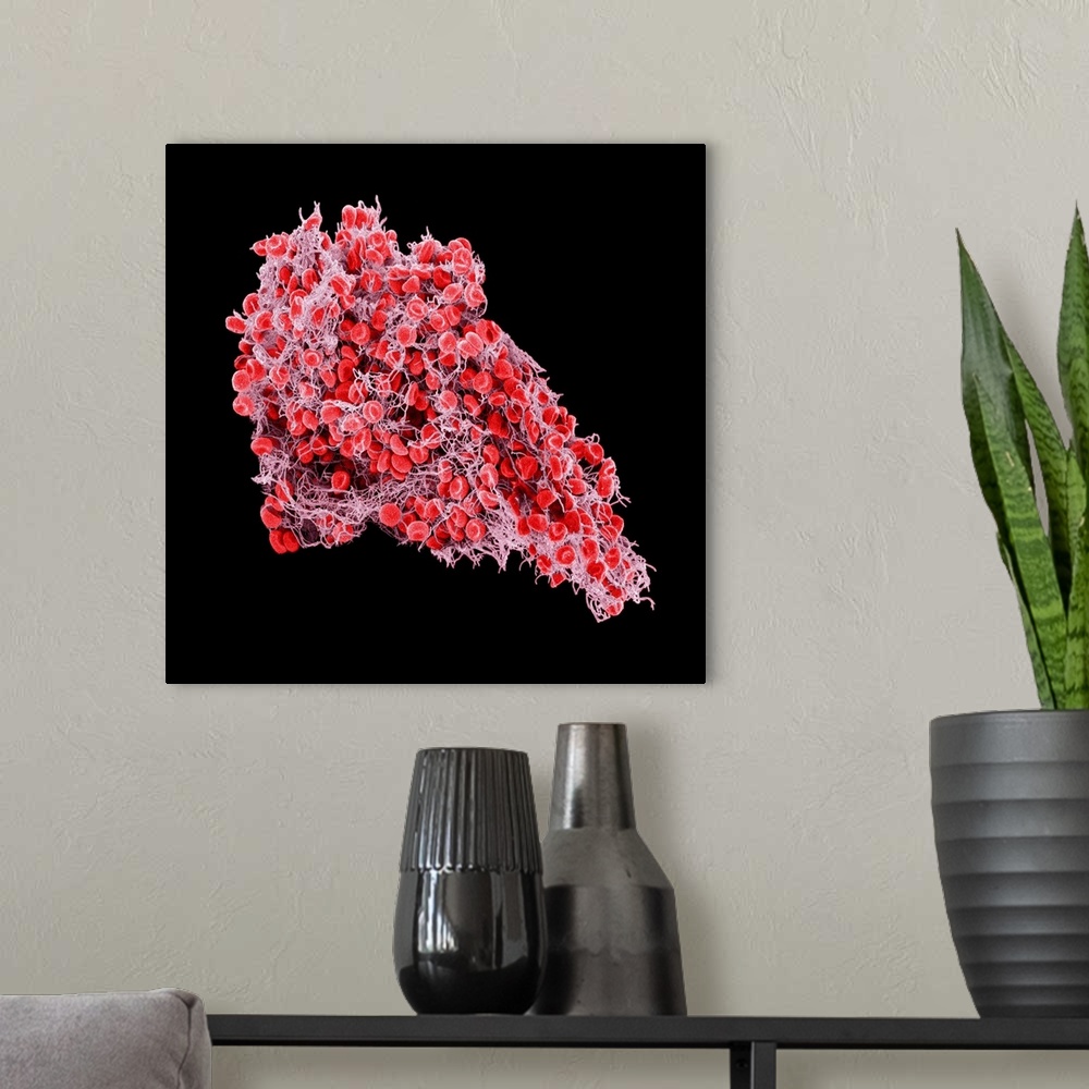 A modern room featuring Blood clot, coloured scanning electron micrograph (SEM). Red blood cells (erythrocytes) are trapp...
