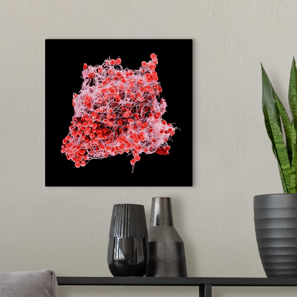 A modern room featuring Blood clot, coloured scanning electron micrograph (SEM). Red blood cells (erythrocytes) are trapp...