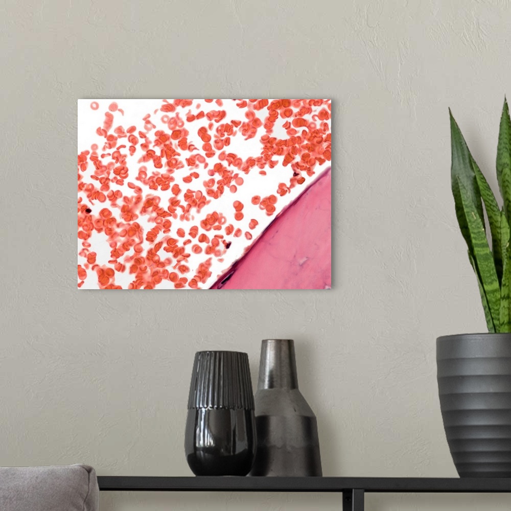A modern room featuring Blood. Light micrograph of red blood cells (erythrocytes, red) in a blood vessel. Bone is at bott...