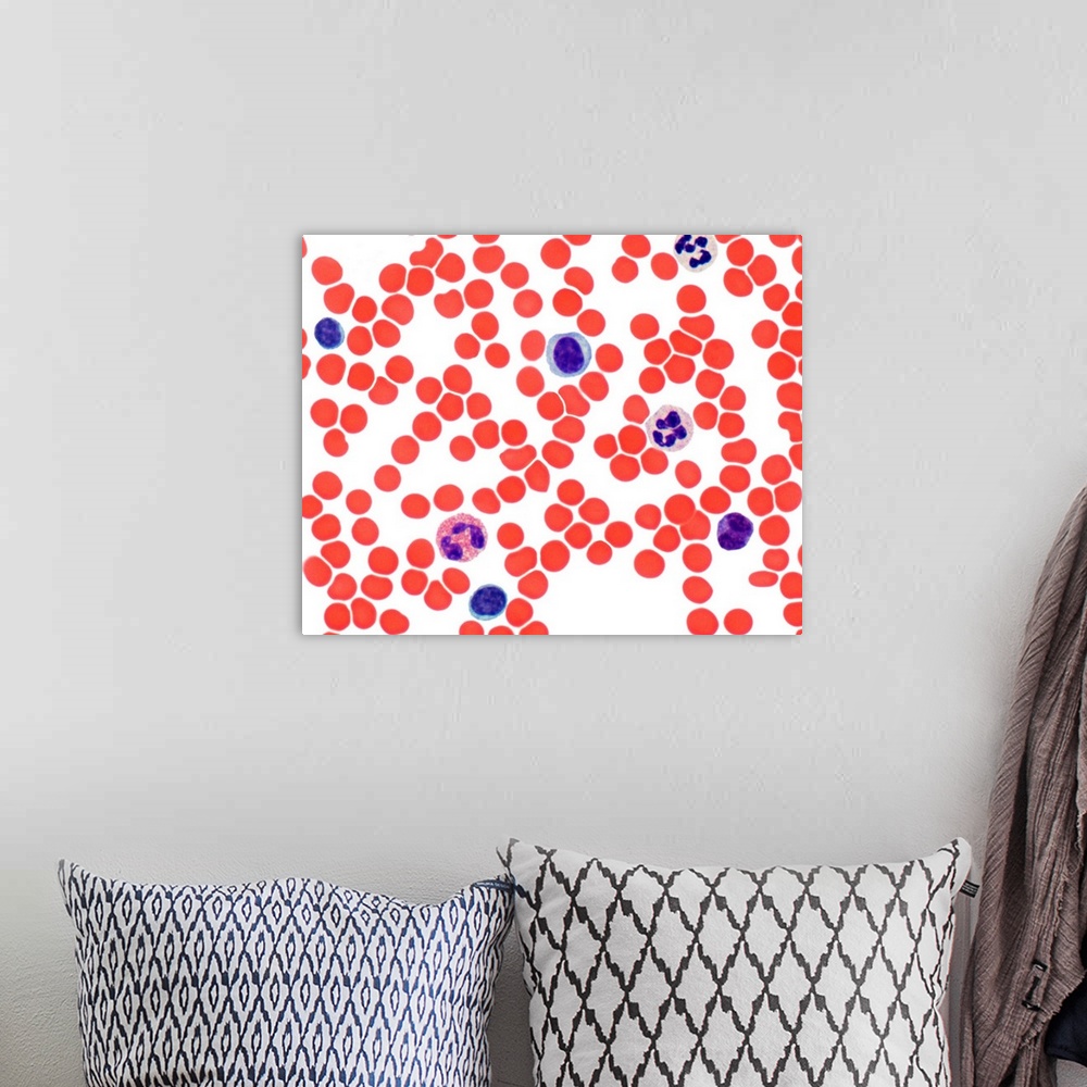 A bohemian room featuring Blood smear. Light micrograph showing normal red and white blood cells. At upper centre is monocy...