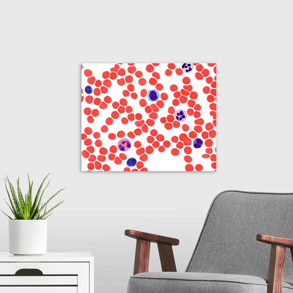 A modern room featuring Blood smear. Light micrograph showing normal red and white blood cells. At upper centre is monocy...
