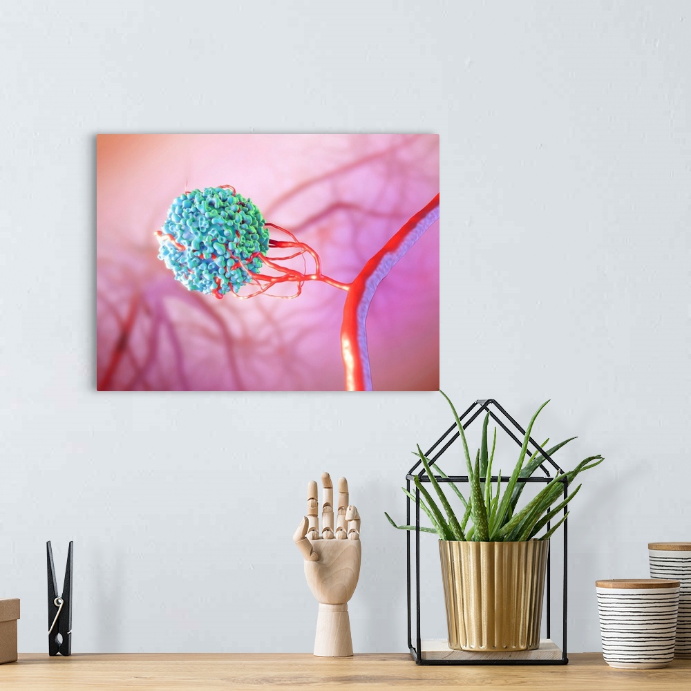 A bohemian room featuring Blood vessel formation. Illustration showing a malignant (cancerous) cell (blue) promoting the fo...