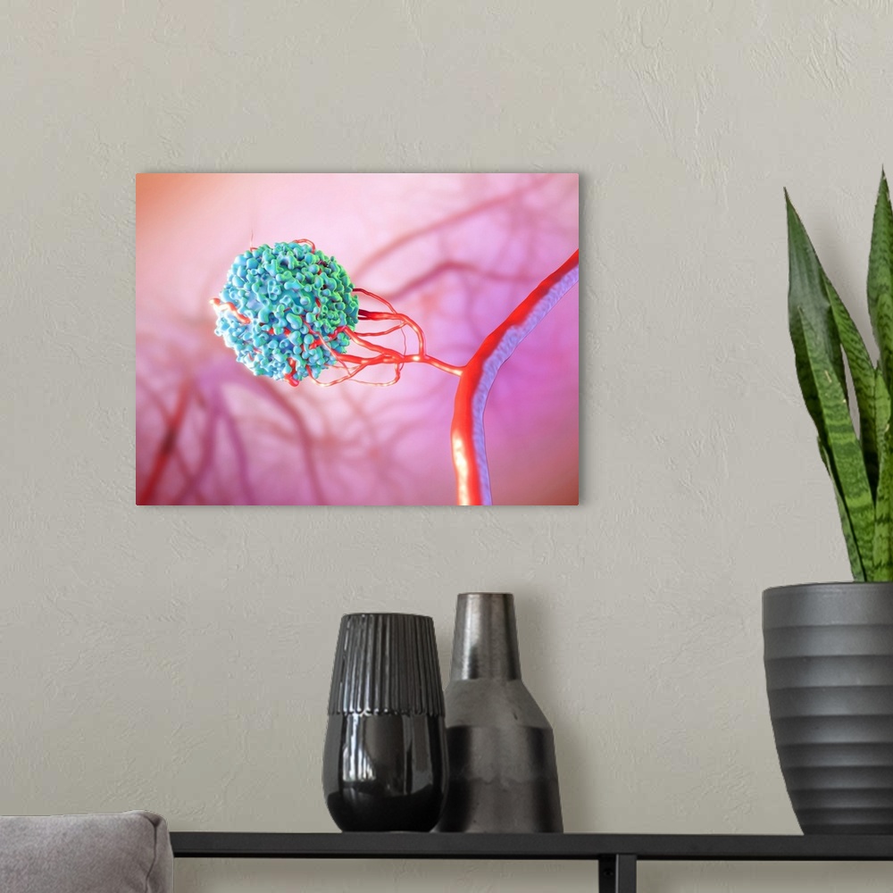 A modern room featuring Blood vessel formation. Illustration showing a malignant (cancerous) cell (blue) promoting the fo...