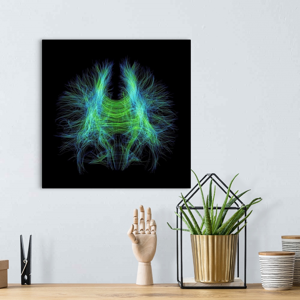 A bohemian room featuring Brain fibres. 3D diffusion tensor imaging (DTI) magnetic resonance imaging (MRI) scan of nerve pa...