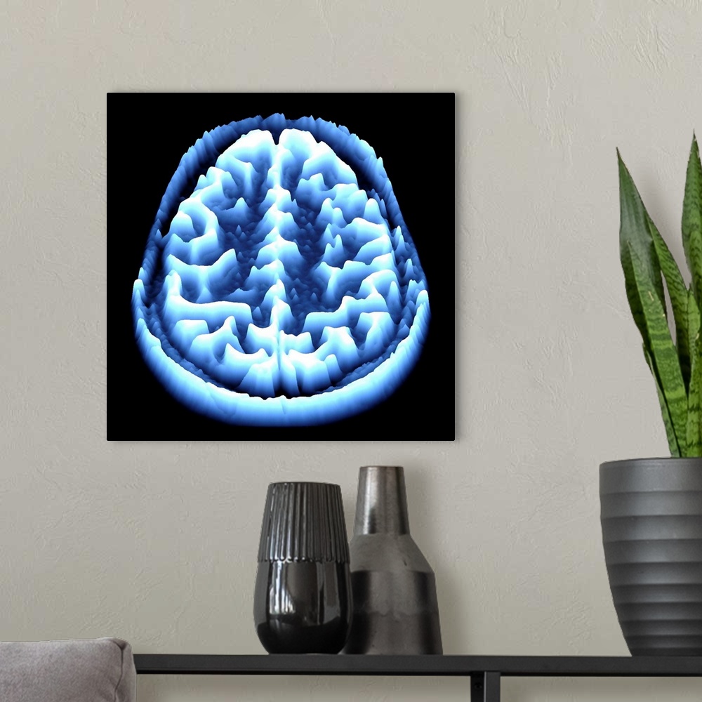A modern room featuring Normal brain. Coloured magnetic resonance imaging (MRI) scan of an axial section through a health...