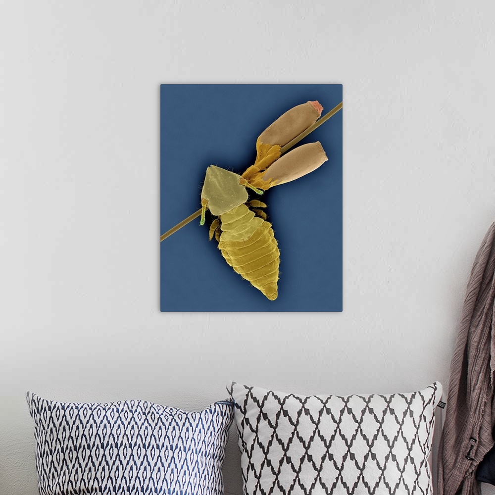 A bohemian room featuring Coloured scanning electron micrograph (SEM) of Cat biting louse and egg cases (Felicola subrostra...