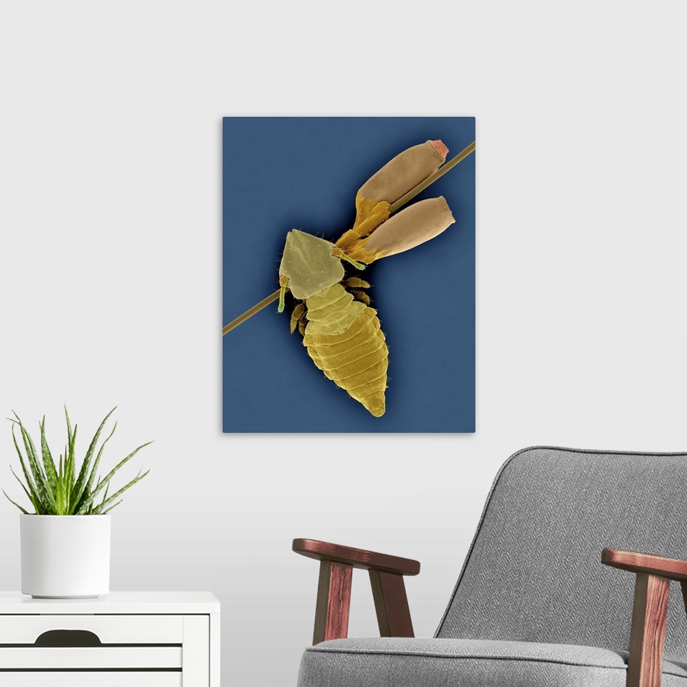 A modern room featuring Coloured scanning electron micrograph (SEM) of Cat biting louse and egg cases (Felicola subrostra...