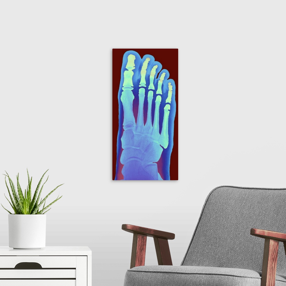 A modern room featuring Child's foot. Coloured X-ray of the healthy right foot of an eight year old girl. The toes are ma...